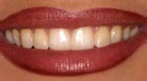 yellow smile without idol white